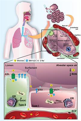 Pathophysiology of SARS-CoV-2 in Lung of Diabetic Patients